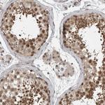 ZNF341 Polyclonal Antibody