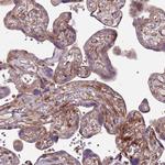 ZNF624 Antibody in Immunohistochemistry (Paraffin) (IHC (P))