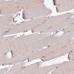 ZNF624 Antibody in Immunohistochemistry (Paraffin) (IHC (P))