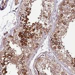 ZNF624 Antibody in Immunohistochemistry (Paraffin) (IHC (P))