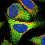 C17orf25 Polyclonal Antibody