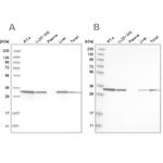 C17orf25 Antibody in Western Blot (WB)