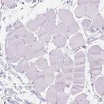 WDR16 Antibody in Immunohistochemistry (Paraffin) (IHC (P))