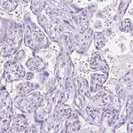 WDR16 Antibody in Immunohistochemistry (IHC)