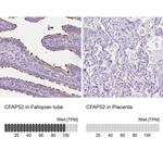 WDR16 Antibody