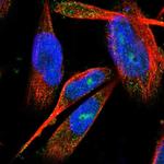 C17orf25 Polyclonal Antibody