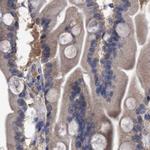 C17orf25 Antibody in Immunohistochemistry (IHC)