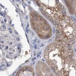C17orf25 Antibody in Immunohistochemistry (IHC)