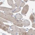 C17orf25 Antibody in Immunohistochemistry (IHC)