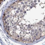 C17orf25 Antibody in Immunohistochemistry (IHC)