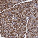 C17orf25 Antibody in Immunohistochemistry (IHC)