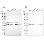 C17orf25 Antibody in Western Blot (WB)