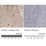 NECAB1 Antibody in Immunohistochemistry (IHC)