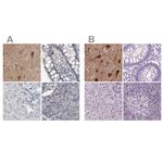 NECAB1 Antibody in Immunohistochemistry (IHC)