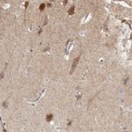NECAB1 Antibody in Immunohistochemistry (IHC)