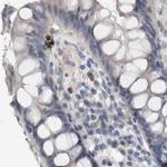 NECAB1 Antibody in Immunohistochemistry (IHC)