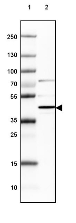 NECAB1 Antibody in Western Blot (WB)