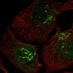 CCDC25 Polyclonal Antibody