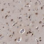 CCDC25 Antibody in Immunohistochemistry (Paraffin) (IHC (P))