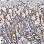 CCDC25 Antibody in Immunohistochemistry (Paraffin) (IHC (P))