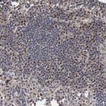 CCDC25 Antibody in Immunohistochemistry (Paraffin) (IHC (P))