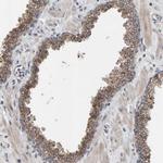 CCDC25 Antibody in Immunohistochemistry (Paraffin) (IHC (P))