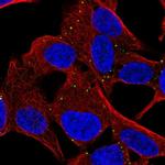 MYCBPAP Polyclonal Antibody