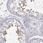 MYCBPAP Antibody in Immunohistochemistry (IHC)