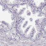 MYCBPAP Antibody in Immunohistochemistry (IHC)