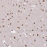 RFK Polyclonal Antibody