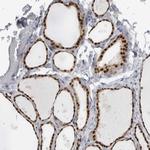 ADPRM Polyclonal Antibody