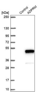 ADPRM Antibody in Western Blot (WB)