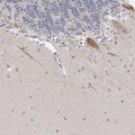 NIPA1 Polyclonal Antibody