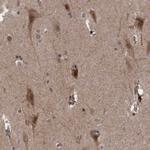 TANC2 Antibody in Immunohistochemistry (Paraffin) (IHC (P))