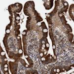 TANC2 Antibody in Immunohistochemistry (Paraffin) (IHC (P))