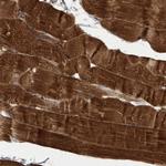 C17orf81 Antibody in Immunohistochemistry (Paraffin) (IHC (P))