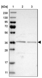 C17orf81 Antibody in Western Blot (WB)