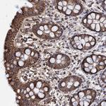 DSCR3 Antibody in Immunohistochemistry (Paraffin) (IHC (P))