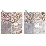 RNMTL1 Antibody in Immunohistochemistry (IHC)