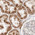 RNMTL1 Antibody in Immunohistochemistry (IHC)