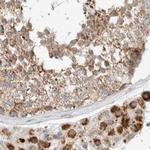 RNMTL1 Antibody in Immunohistochemistry (IHC)
