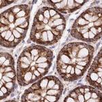 RNMTL1 Antibody in Immunohistochemistry (IHC)