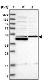 RNMTL1 Antibody in Western Blot (WB)