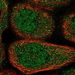 NPLOC4 Polyclonal Antibody
