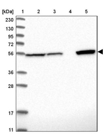 ALDH7A1 Antibody in Western Blot (WB)