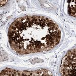 AMZ2 Antibody in Immunohistochemistry (Paraffin) (IHC (P))