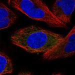 SRP68 Polyclonal Antibody