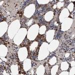 SRP68 Antibody in Immunohistochemistry (Paraffin) (IHC (P))
