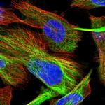 TOM1L2 Polyclonal Antibody