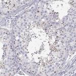 FAM166A Antibody in Immunohistochemistry (IHC)